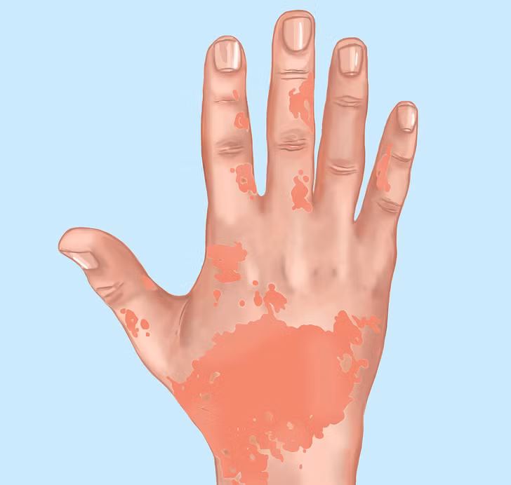 8 dau hieu canh bao co the ban toan doc to hinh anh 4