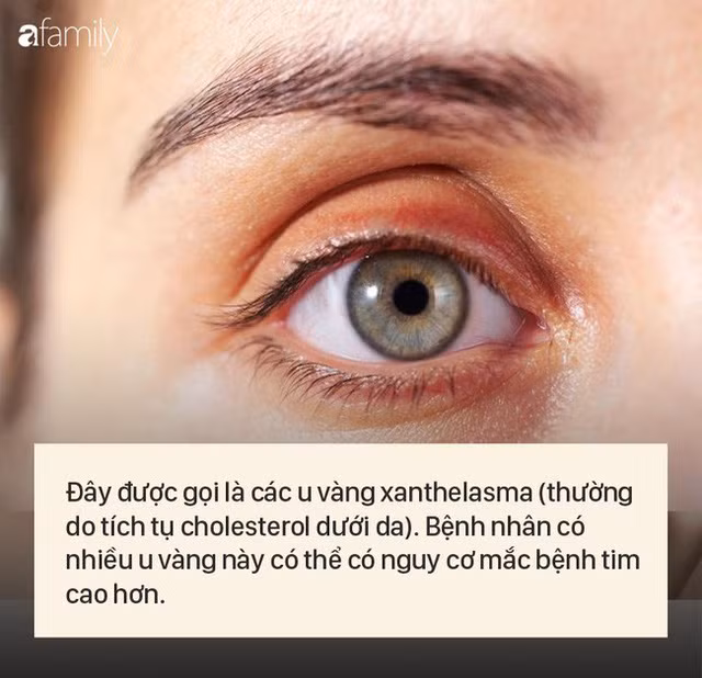 8 dấu hiệu cảnh báo bệnh được “khắc” rất rõ trên khuôn mặt của bạn - Ảnh 3.