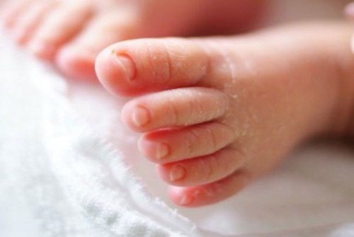 Bé 8 tháng lở loét chân vì đi tất không đúng cách ảnh 1 Bé 8 tháng lở loét chân vì đi tất không đúng cách ảnh 1