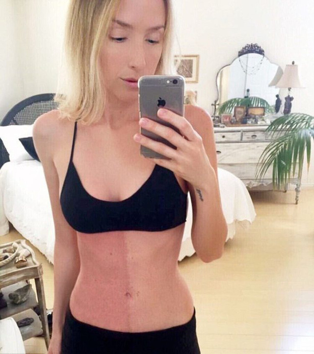 Kỳ lạ người phụ nữ có hai màu da, hai hệ miễn dịch khác nhau ảnh 1