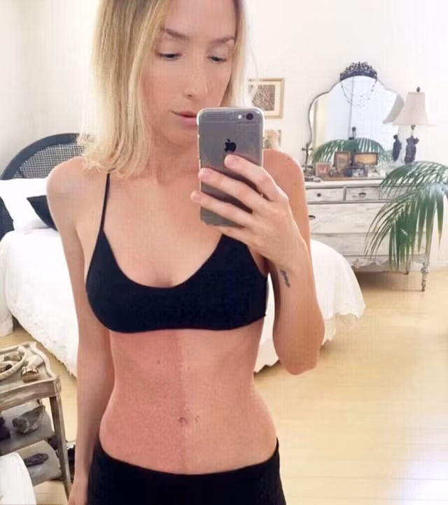 Kỳ lạ người phụ nữ có hai màu da, hai hệ miễn dịch khác nhau ảnh 1