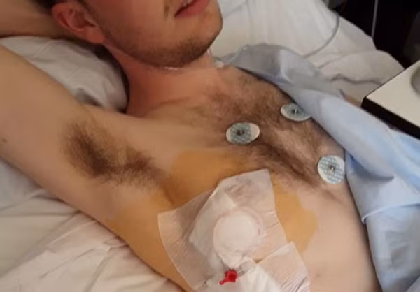 Chàng trai 20 tuổi thủng phổi sau khi chơi tàu lượn siêu tốc-2