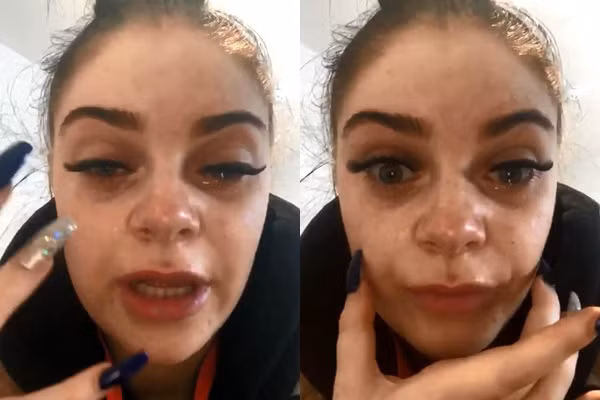 Cô gái trẻ tố chủ thẩm mỹ dùng keo gắn móng tay để nối mi hại cô sưng vù mắt và còn suýt bị mù