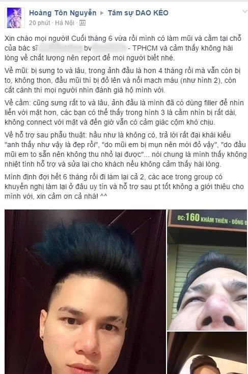 Hậu quả khó lường khi sao Việt phẫu thuật thẩm mỹ đổi vận