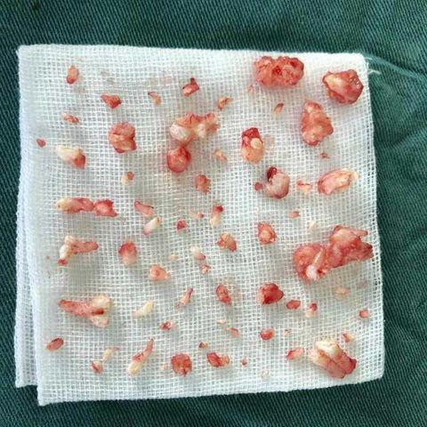 cau be 9 tuoi co 70 chiec rang, bs nhac neu rang tre mai khong moc nen kham ngay - 4