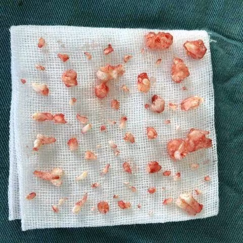 cau be 9 tuoi co 70 chiec rang, bs nhac neu rang tre mai khong moc nen kham ngay - 4