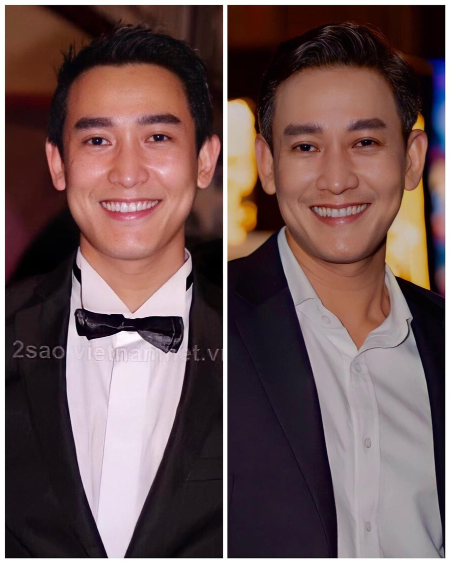 Hứa Vĩ Văn chia sẻ về hình ảnh so sánh giữa 30 tuổi và 43 tuổi Hứa Vĩ Văn chia sẻ về hình ảnh so sánh giữa 30 tuổi và 43 tuổi