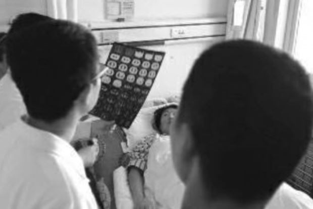 Người phụ nữ ăn ớt bị kẹt trong phổi suốt 6 năm mà không biết - Ảnh 1. Người phụ nữ ăn ớt bị kẹt trong phổi suốt 6 năm mà không biết - Ảnh 1.