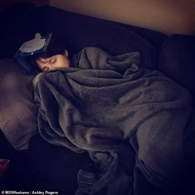 bi bong dap vao dau, co gai khong ngo phai chiu hau qua dau don suot 8 nam - 3