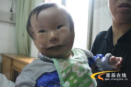 Đáng thương cậu bé có 2 mặt