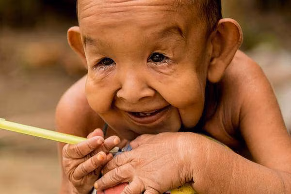 nhung can benh "ky di" nhat the gioi ma toan bo gioi y hoc cung phai "bo tay" - 2