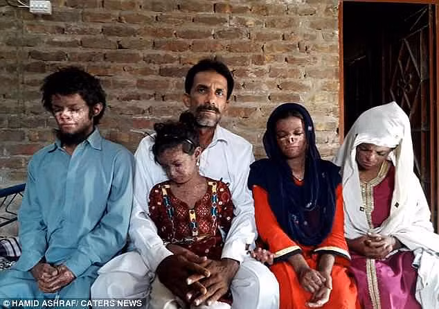 4 đứa con bị hàng xóm hắt hủi vì mắc bệnh lạ, người cha khốn khổ phải cầu xin sự giúp đỡ của mọi người - Hình 2