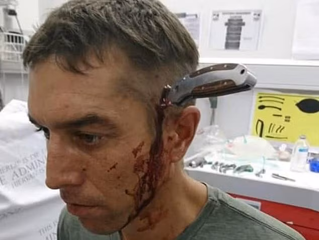 Shaun Wayne bị dao đâm xuyên đầu.