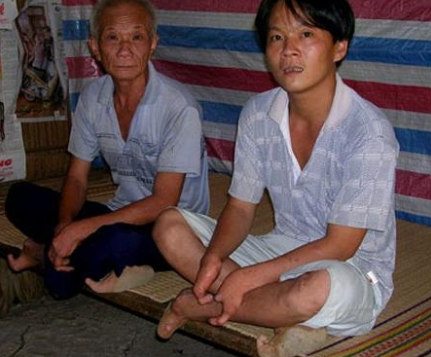 Gia tộc những người có bàn tay, chân "dị ngón" tài hoa ở Trà Vinh hình ảnh 3 gia toc nhung nguoi co ban tay, chan "di ngon" tai hoa o tra vinh hinh anh 3