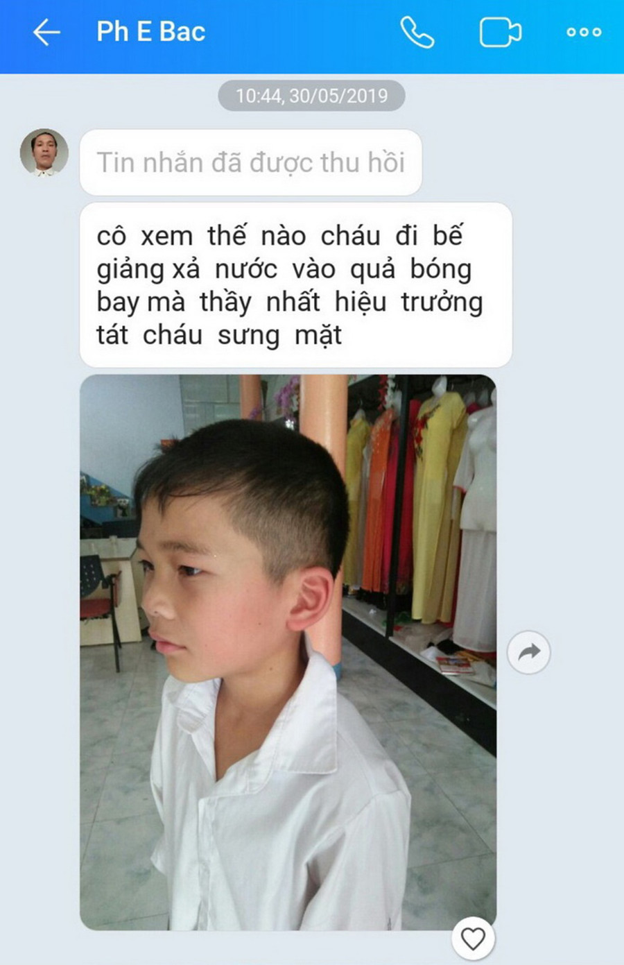 Ảnh em N.H.B. sau lễ bế giảng, nghi bị ông Nguyễn Văn Nhất véo tai, tát vào má. Ảnh do phụ huynh gửi, Phòng GD&ĐT cung cấp Ảnh em N.H.B. sau lễ bế giảng, nghi bị ông Nguyễn Văn Nhất véo tai, tát vào má. Ảnh do phụ huynh gửi, Phòng GD&ĐT cung cấp