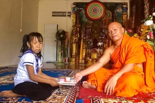 Bi kịch bé gái có khuôn mặt già như bà lão