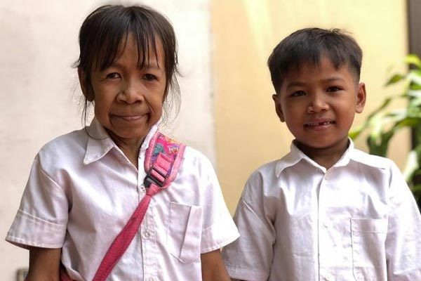 Bo bên anh ruột - Chea, 11 tuổi. Ảnh: Viral Press. Bi kịch bé gái có khuôn mặt già như bà lão