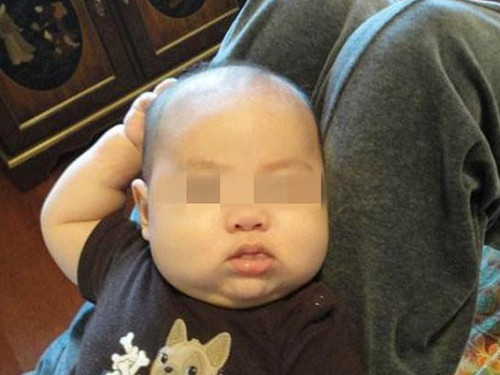 Con gãi đầu liên tục nhưng cha mẹ vô tâm bỏ qua, đưa vào viện mới sững sờ khi biết lý do - Ảnh 1.