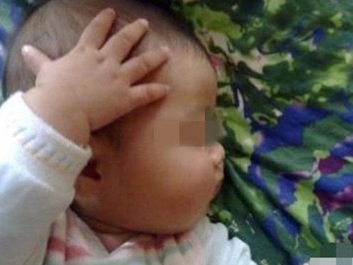 Con gãi đầu liên tục nhưng cha mẹ vô tâm bỏ qua, đưa vào viện mới sững sờ khi biết lý do - Ảnh 2.