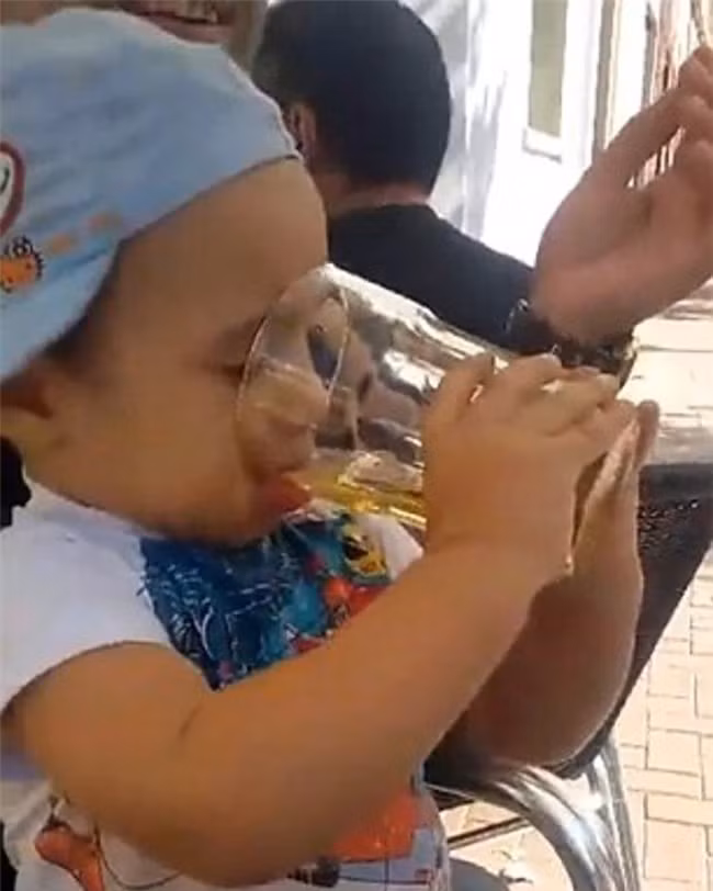 Bé trai xấu số đã sống cảnh thực vật vì một ngụm bia