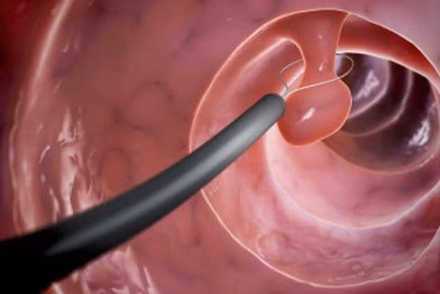 nguoi dan ong hai hung non ra “khoi thit” 10cm - 3