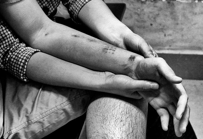 Những người đang phải chạy thận nhân tạo và mong chờ được ghép thận, trọ tại Hà Nội. Những người đang phải chạy thận nhân tạo và mong chờ được ghép thận, trọ tại Hà Nội. Ảnh: Đỗ Mạnh Cường.