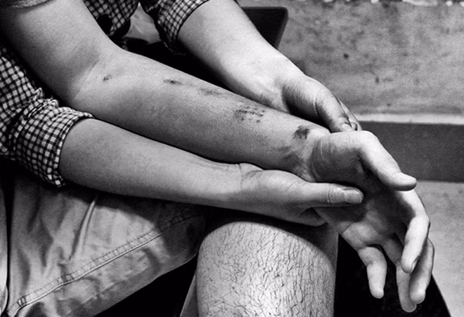 Những người đang phải chạy thận nhân tạo và mong chờ được ghép thận, trọ tại Hà Nội. Ảnh: Đỗ Mạnh Cường.