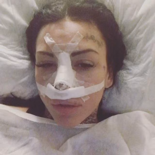 Phẫu thuật gót chân để trông cao hơn - 3