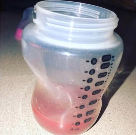 Bà mẹ có sữa chuyển sang màu hồng ảnh 1