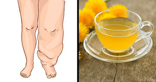 Các loại thực phẩm và đồ uống giúp cơ thể thoát khỏi bị giữ nước ảnh 10 Các loại thực phẩm và đồ uống giúp cơ thể thoát khỏi bị giữ nước ảnh 10