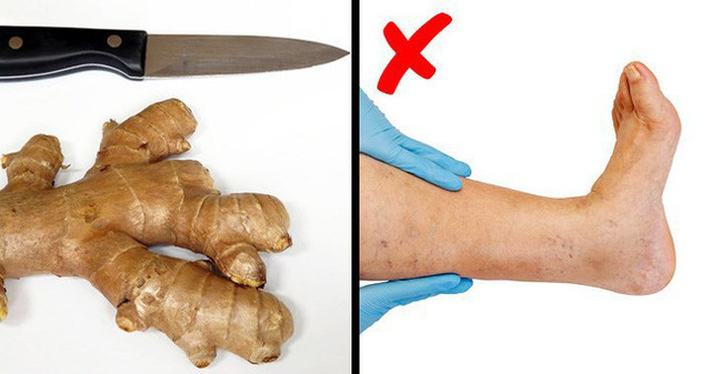 Các loại thực phẩm và đồ uống giúp cơ thể thoát khỏi bị giữ nước ảnh 5 Các loại thực phẩm và đồ uống giúp cơ thể thoát khỏi bị giữ nước ảnh 5