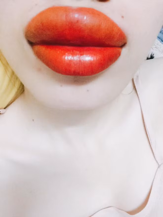 Ham xăm môi căng mọng, cô gái trẻ nước mắt hai hàng nhìn đôi môi sưng tều, cháy sém như quả táo héo - Ảnh 6.