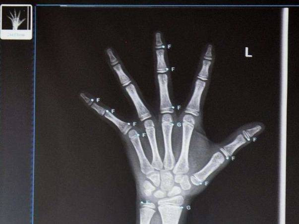 be 9 tuoi vinh vien khong the cao them vi nhung mon me viet hay cho con an hang ngay - 3