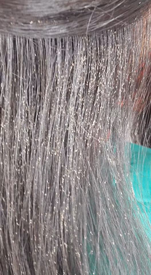 Rùng mình với tổ chấy hàng nghìn con tranh nhau làm tổ trưởng trên đầu bé gái-1