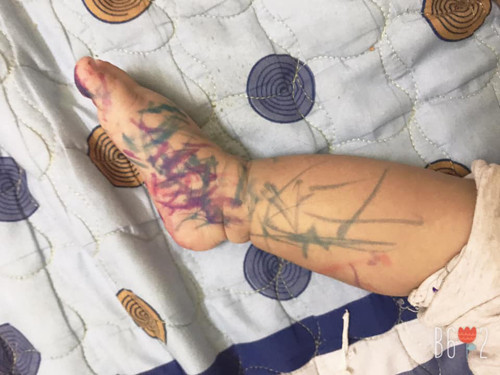 Chân của cậu con trai...