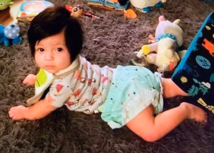 Bé gái bị rạn sọ não trong tình trạng nguy kịch