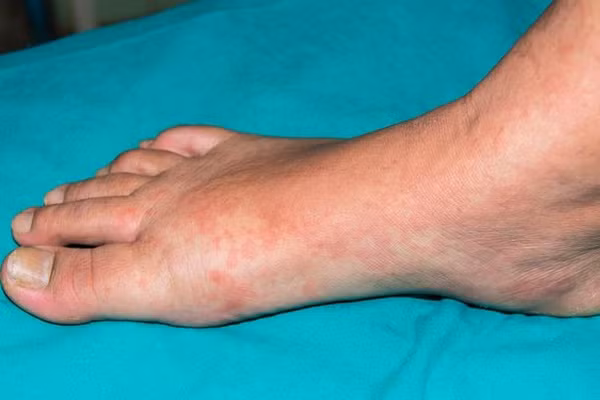 10 thay đổi trên da tố cáo bạn đang mắc bệnh, càng để lâu càng nguy hiểm đến tính mạng-2