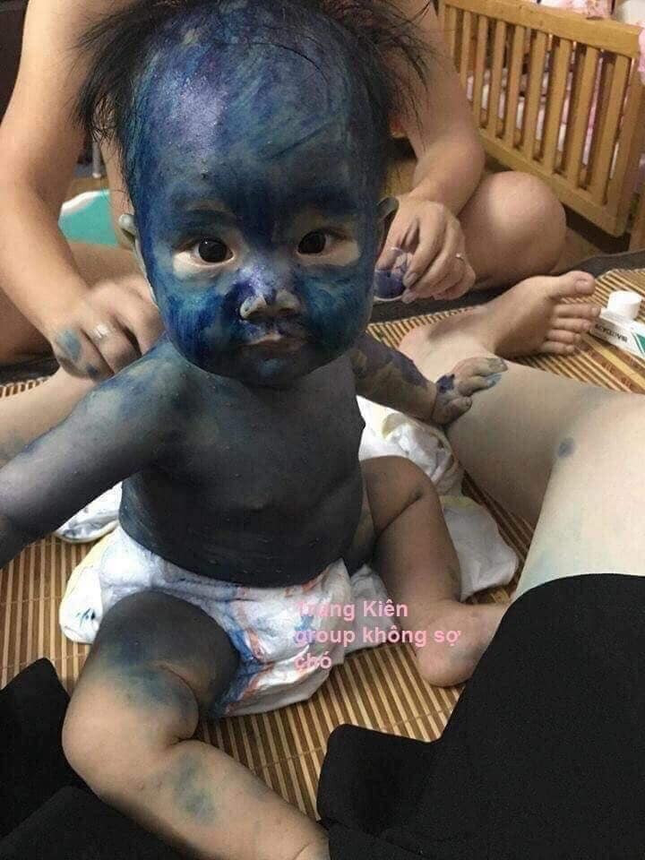 Bôi nhầm còn hơn bỏ xót.