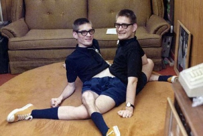 Bí mật phía sai cuộc sống của những cặp song sinh dính liền nhau ảnh 5 Cuộc sống của những cặp song sinh dính liền nhau