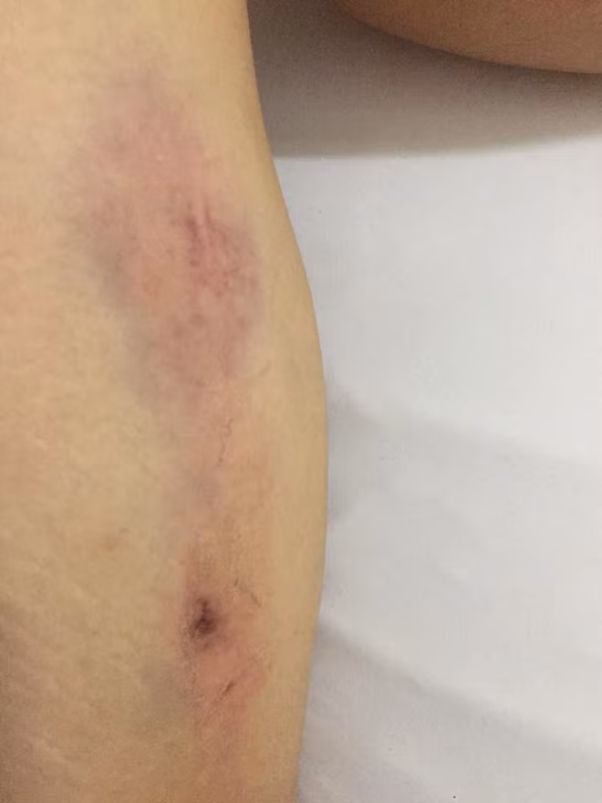 Cô đăng kèm những hình ảnh bị thương sau vụ tai nạn.