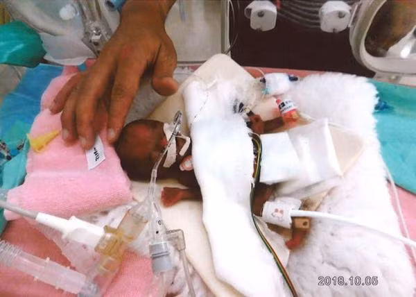 chao doi nang von ven 2,5 lang, cau be song sot nhu ki tich khien ca the gioi tram tro - 2