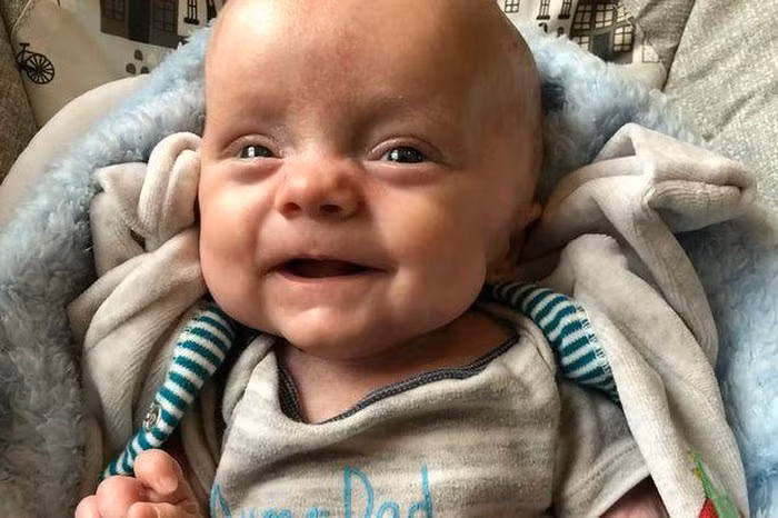 Sinh ra không có da, em bé sống sót thần kỳ