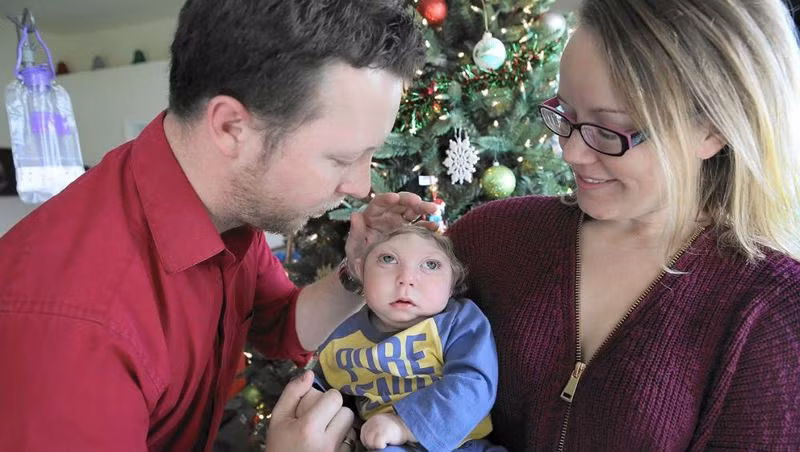 Sức sống mãnh liệt của cậu bé sinh ra với nửa họp sọ