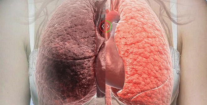 5 món ăn bình dân giúp lọc phổi sạch bong, thải mọi độc tố ra khỏi cơ thể ảnh 1 Empty