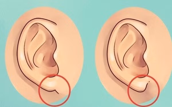 Phúc lộc trong cuộc sống của mỗi người thường được thể hiện trên dái tai của người đó.