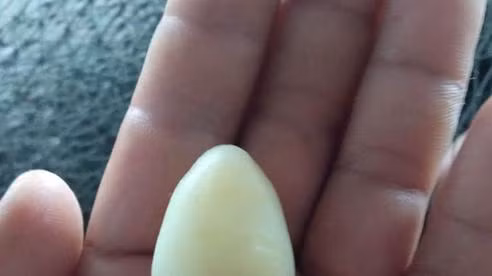 "Viên ngọc" hình trái tim lấy được từ bụng cá bớp.