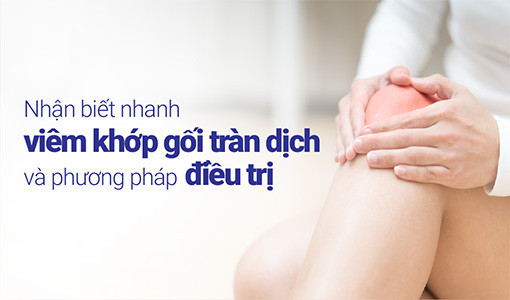 Nhận biết nhanh viêm khớp gối tràn dịch có ý nghĩa quan trọng.