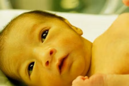 Bệnh lý vàng da ở trẻ sơ sinh có thể được phát hiện bằng mắt thường.