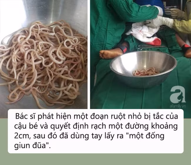 Tưởng chỉ đau bụng bình thường nhưng thứ bác sĩ lấy ra từ bụng bé trai 4 tuổi khiến nhiều người chết ngất