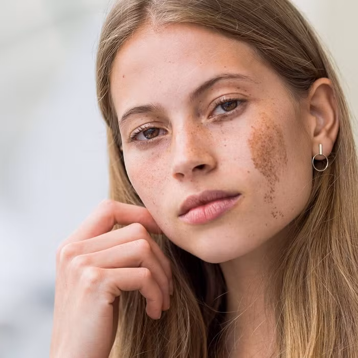 phu-nu-ca-doi-song-trong-nhung-lua-neu-so-huu-nhung-vet-bot-la-1c91a9